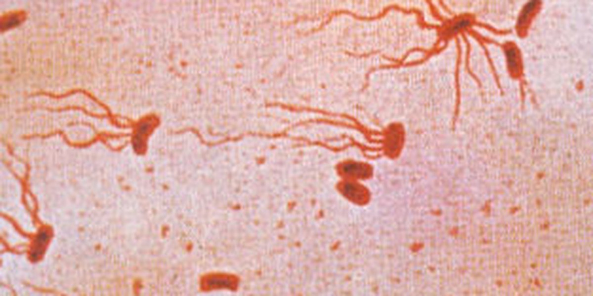 A microscopic view of typhoid fever.